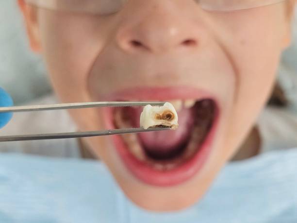 Best Emergency Pediatric Dental Care in Walnut Creek, OH